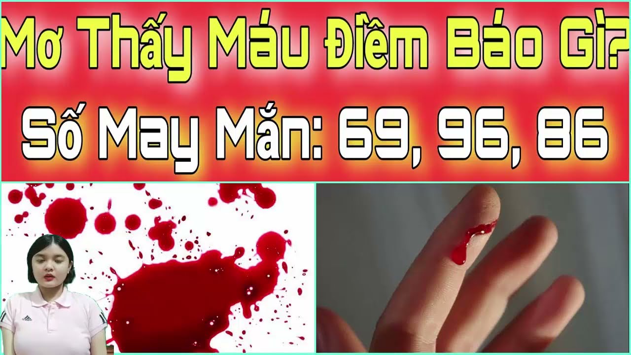 Nằm mơ thấy máu - Điềm báo gì?