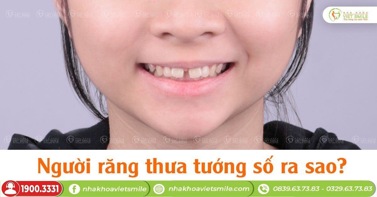 Nằm mơ thấy rụng răng đánh số mấy Ý nghĩa và điềm báo gì?